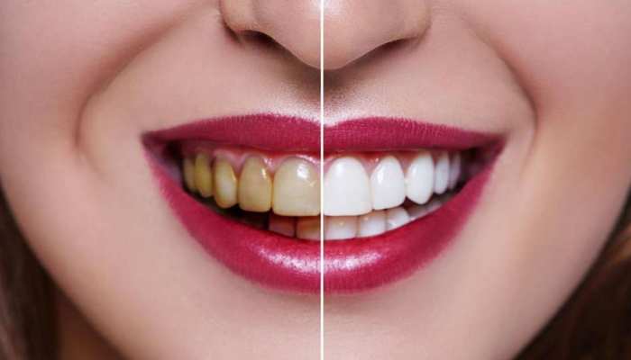 20042022-teeth-health
